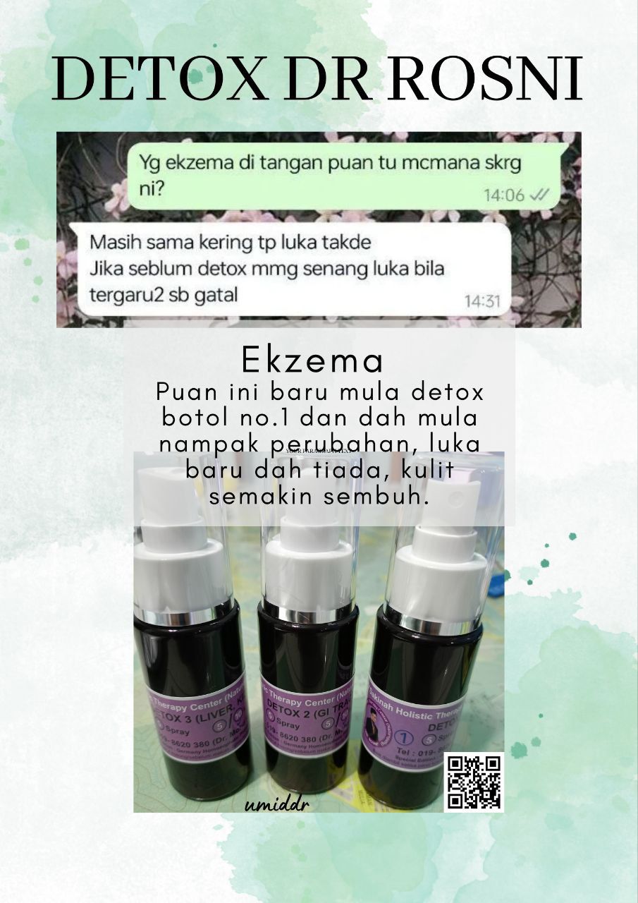 𝗘𝗞𝗭𝗘𝗠𝗔